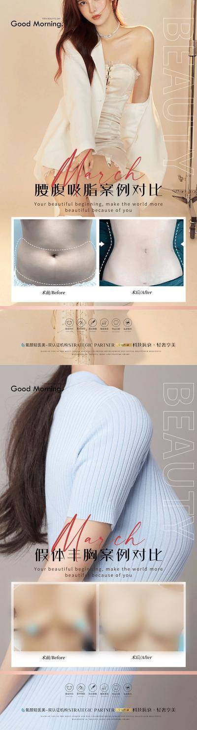 【南门网dcpsd.com】海报 医美 整形 案例 对比  吸脂 假体隆胸 丰胸 人物 