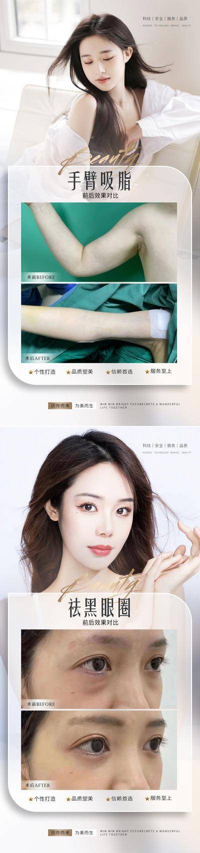 【南门网dcpsd.com】海报 医美 整形 美业 美容 案例 对比 人物 祛眼袋 吸脂 系列