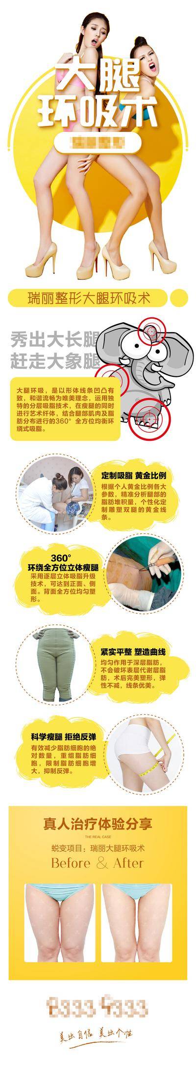 【南门网dcpsd.com】电商详情页 淘宝详情页 医美 整形 美容 吸脂 脂肪 大腿吸脂 案例 对比 分享