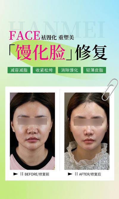 【南门网dcpsd.com】海报 医美 整形 馒化脸 修复 减脂 消除 轻薄 案例 对比