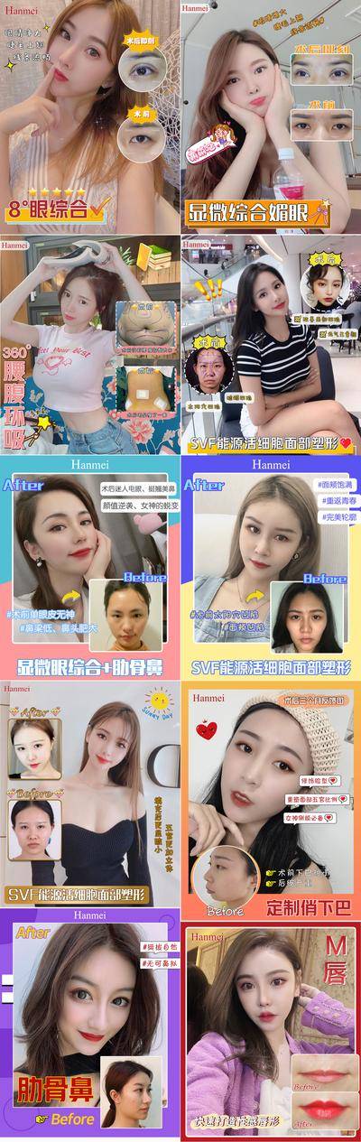 【南门网dcpsd.com】海报 医美 整形 案例 对比 市场 人物 双眼皮 隆鼻 填充 吸脂