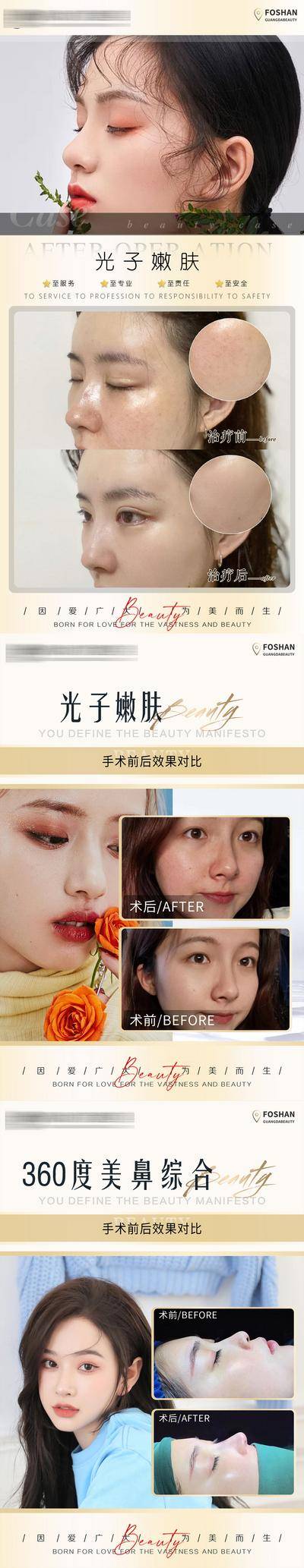 【南门网dcpsd.com】海报 医美 整形 美业 美容 案例 对比 鼻子 美鼻 光子嫩肤 系列