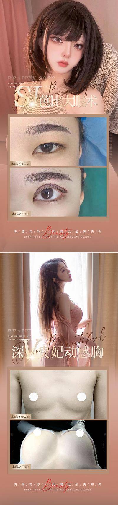 【南门网dcpsd.com】海报 医美 整形 眼综合 眼睛 案例 对比 简约