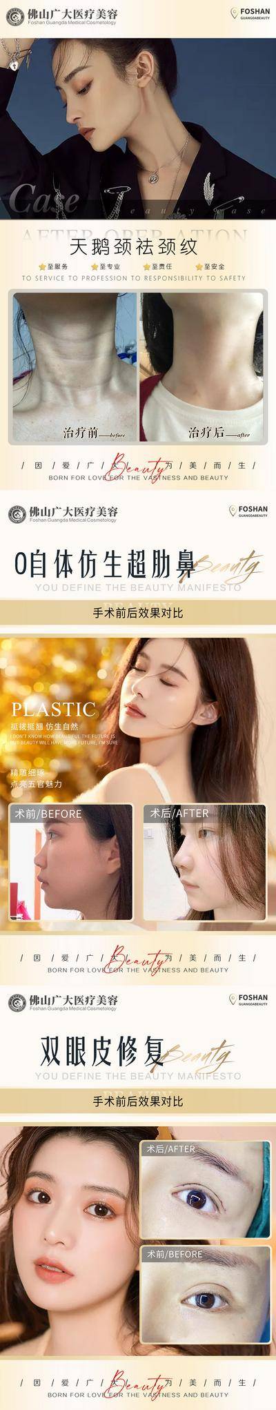 【南门网dcpsd.com】海报 医美 整形 案例 对比 天鹅颈 祛颈纹 系列