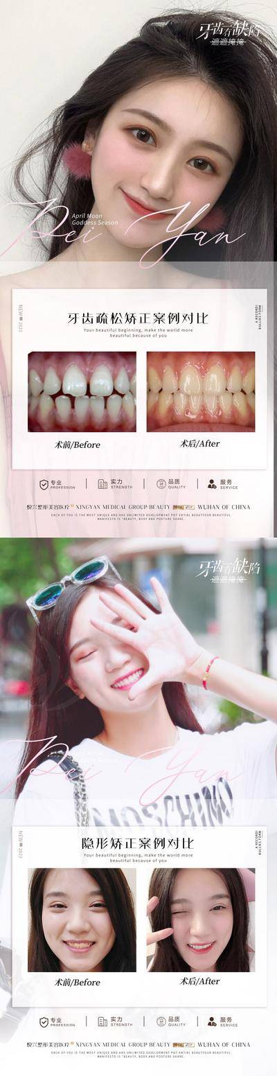 【南门网dcpsd.com】海报 医美 口腔 牙科 案例 对比 简约 人物 系列
