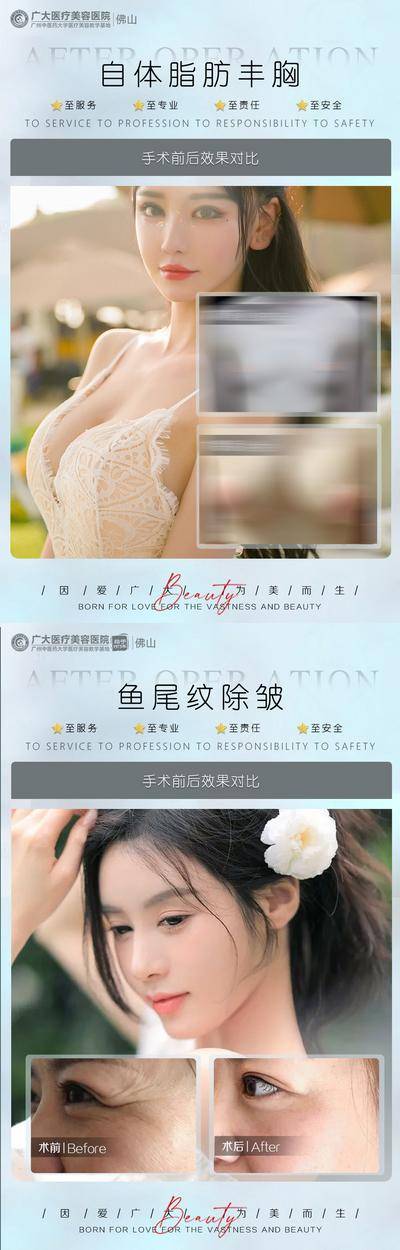 【南门网dcpsd.com】海报 医美 整形 美业 美容 案例 对比 嗨体 祛颈纹 水光针 双眼皮 系列