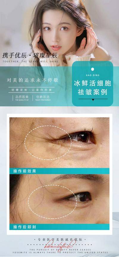 【南门网dcpsd.com】海报 医美 案例 对比 人物