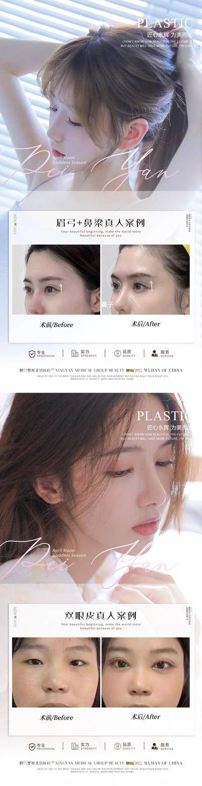 【南门网dcpsd.com】广告 海报 医美 整形 案例 人物 对比 系列