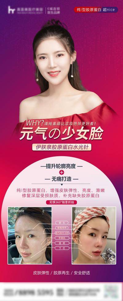 【南门网dcpsd.com】海报 医美 整形 美容 人物 案例 对比 伊肤泉 水光针 胶原蛋白