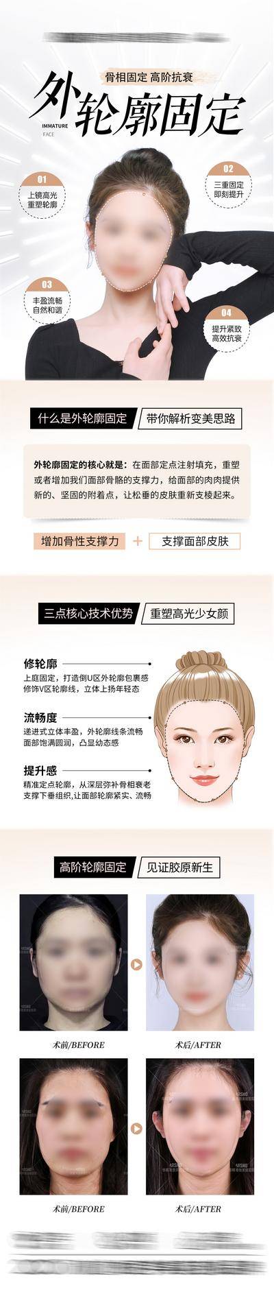 【南门网dcpsd.com】专题设计 长图 医美 项目 科普 幼态脸 外轮廓固定 案例对比