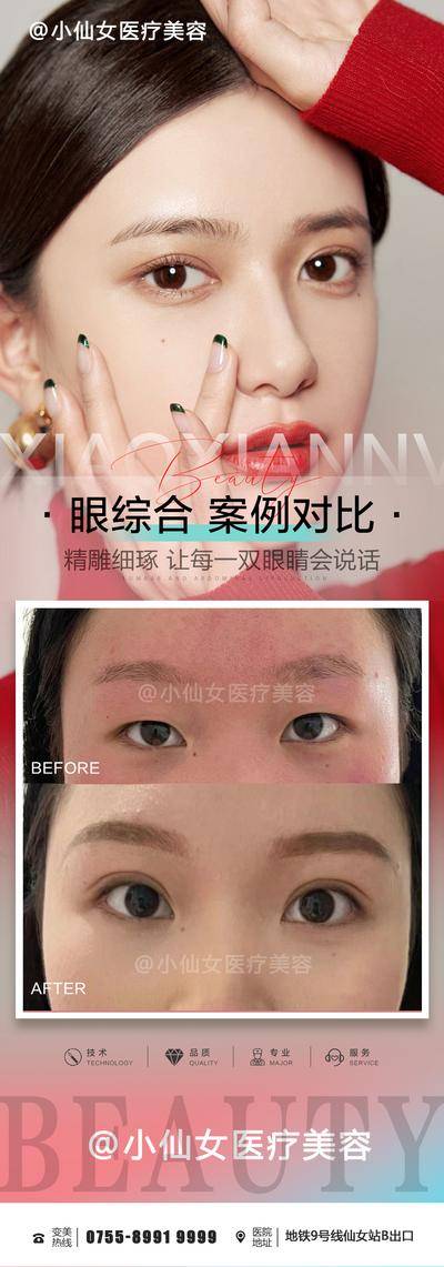 【南门网dcpsd.com】海报 医美 整形 眼综合 双眼皮 案例 对比 明眸 人物