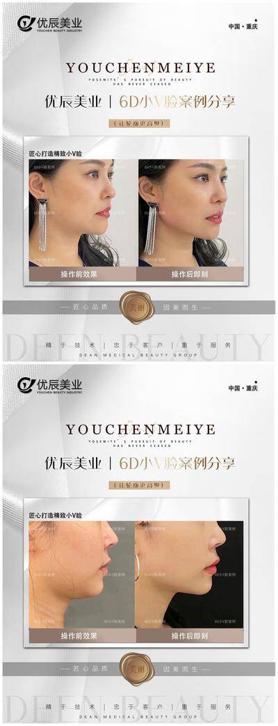 【南门网dcpsd.com】海报 医美 案例 对比图 简约 模特 系列