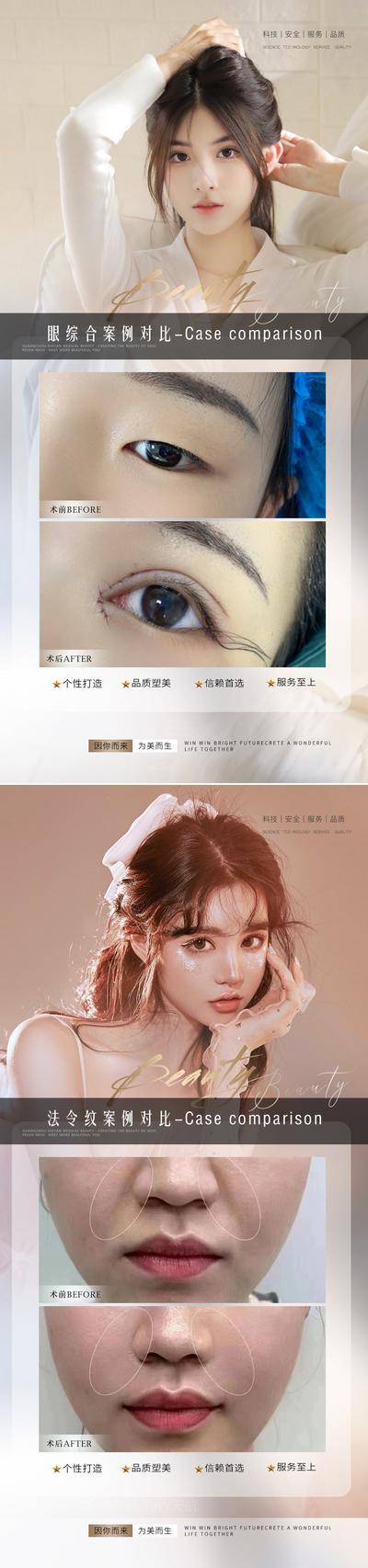 【南门网dcpsd.com】海报 医美 整形 美业 美容 案例 对比 人物 双眼皮 抗衰 美女 人物 系列