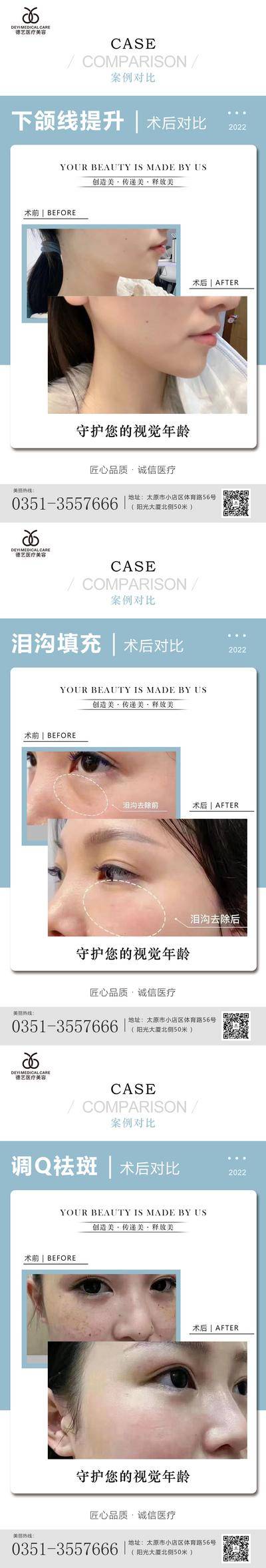 【南门网dcpsd.com】海报 医美 案例 对比图 简约 项目