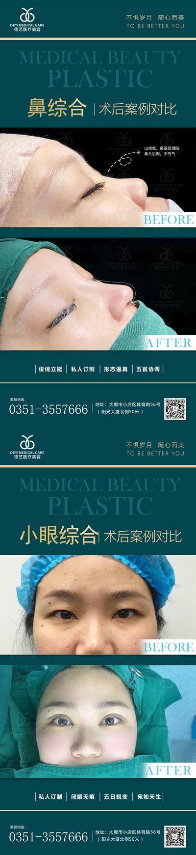 【南门网dcpsd.com】海报 医美 整形 美容 案例 对比图 宣传