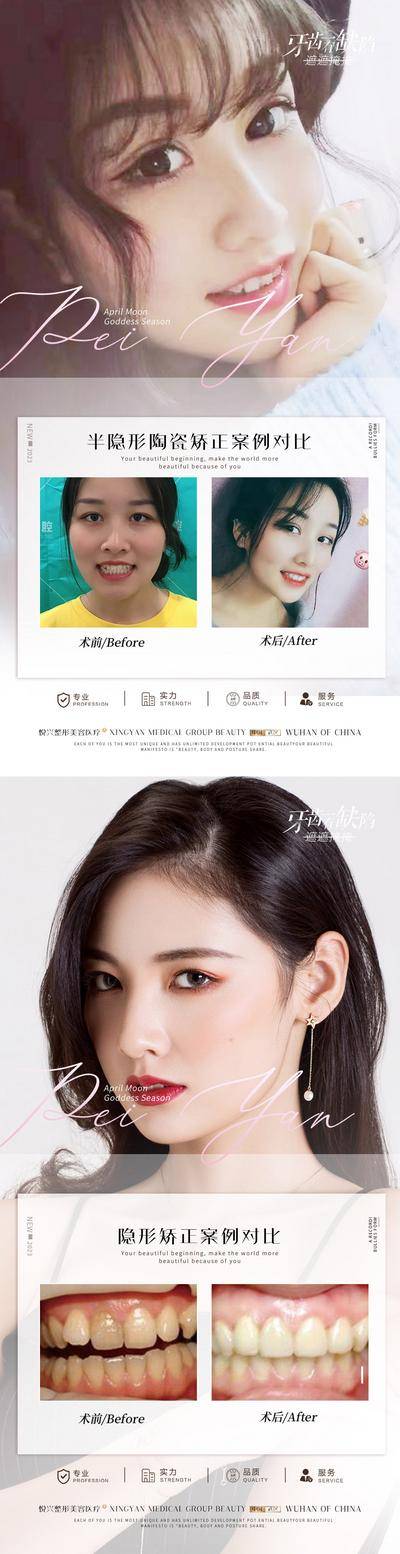 【南门网dcpsd.com】海报 医美 口腔 牙科 案例 对比 简约 人物