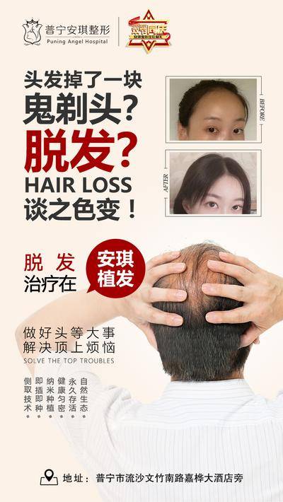 【南门网dcpsd.com】海报 医美 整形 植发 案例 对比 发际线 头顶 种植