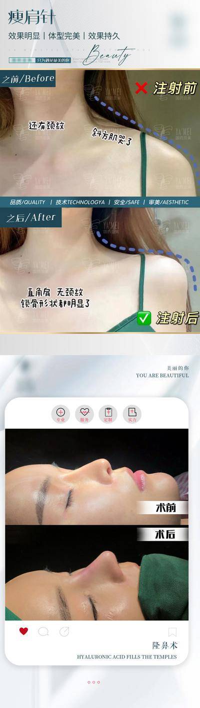 【南门网dcpsd.com】海报 医美 案例 对比图 人物 项目