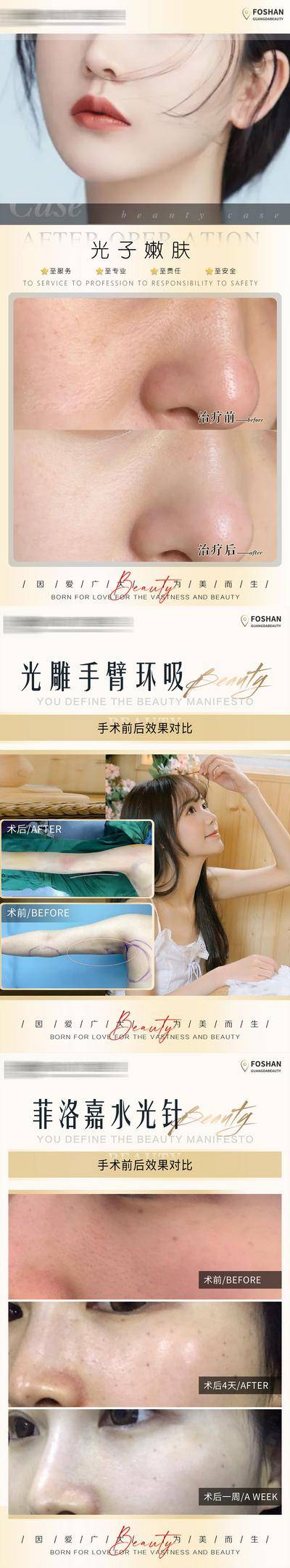 【南门网dcpsd.com】海报 医美 整形 美业 美容 案例 对比 简约 人物