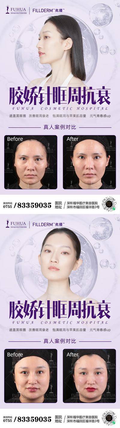 【南门网dcpsd.com】海报 医美 整形 案例对比 紫色