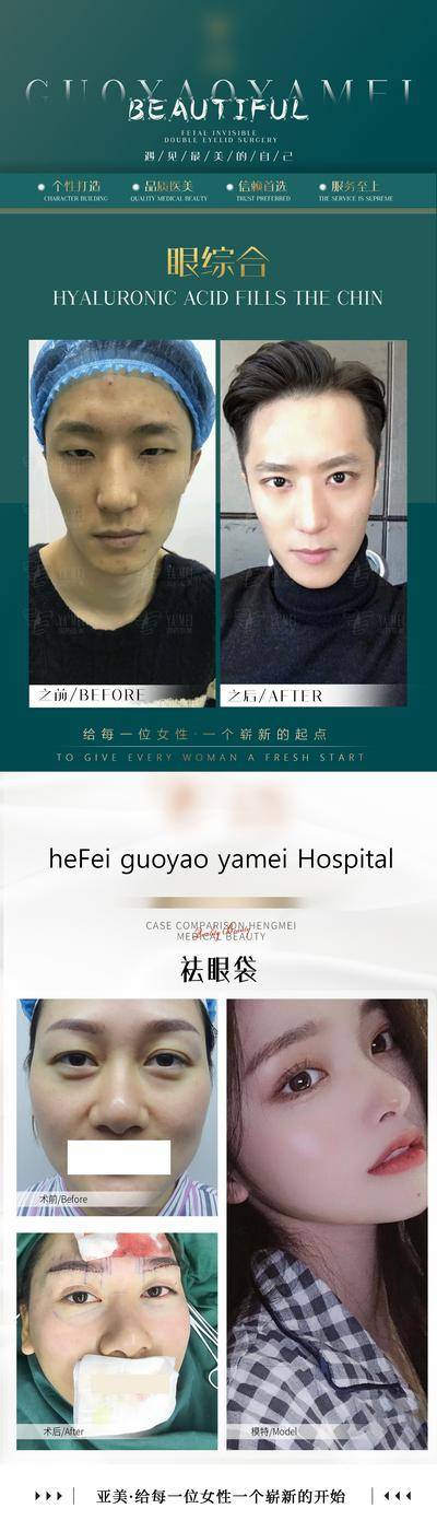 【南门网dcpsd.com】海报 长图 医美 案例 对比 简约