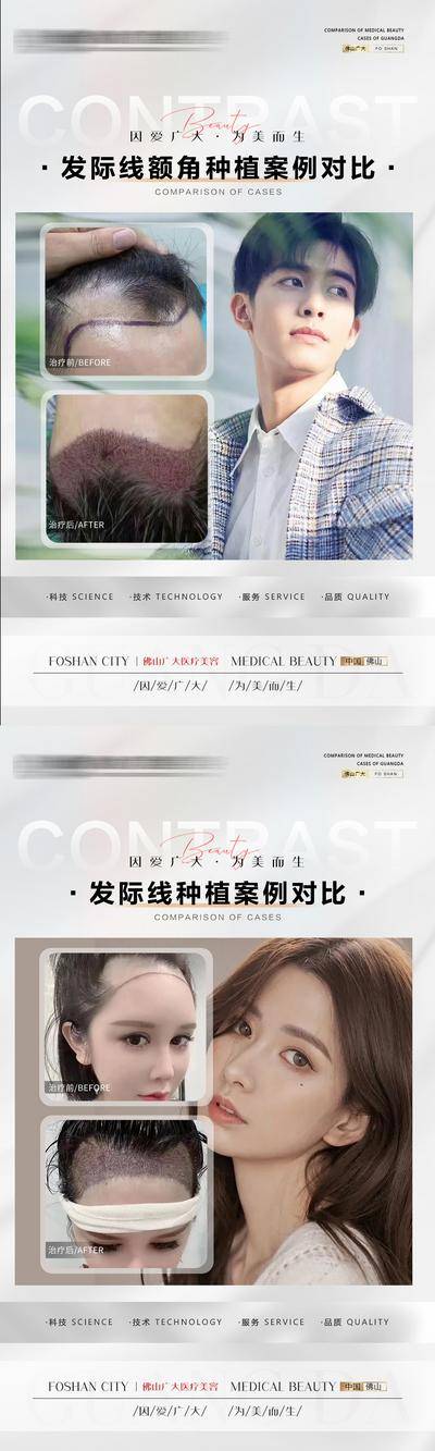 【南门网dcpsd.com】海报 医美 整形 植发 案例 对比 种植 人物 系列