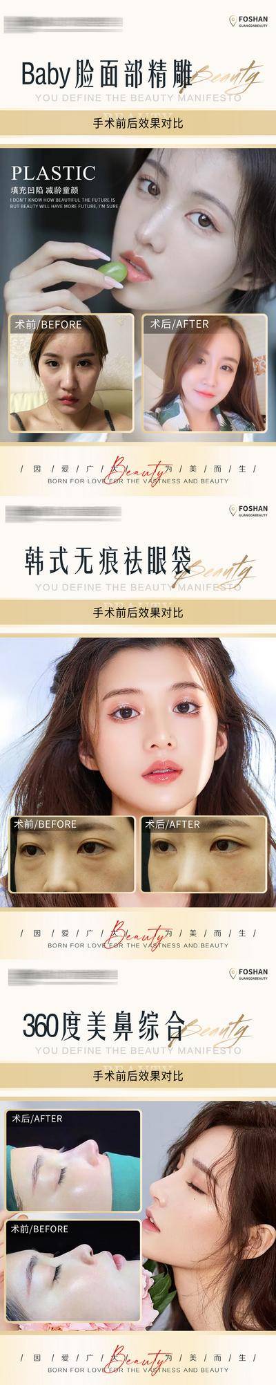 【南门网dcpsd.com】海报 医美 整形 美业 美容 案例 对比 简约 人物