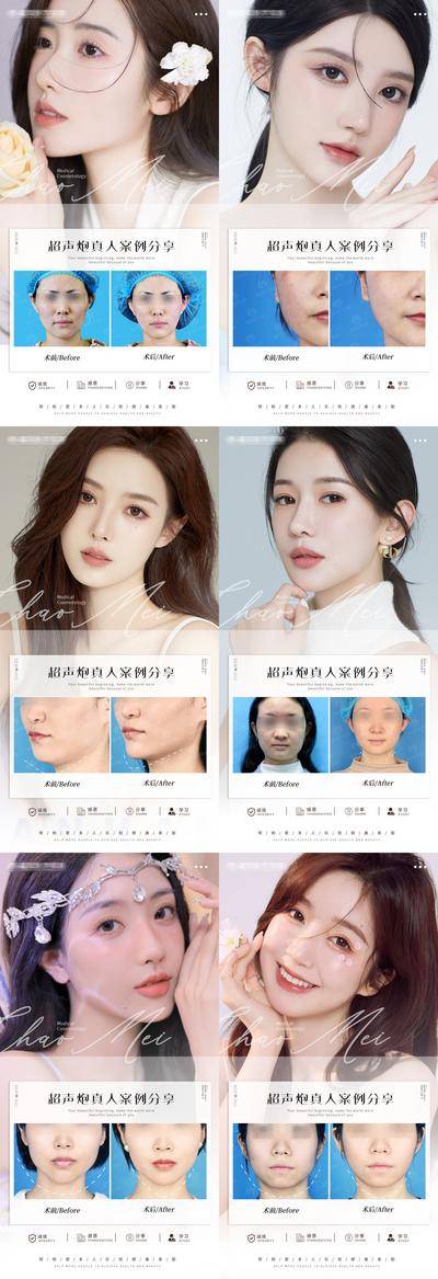 【南门网dcpsd.com】海报 医美 整形 超声炮 案例 对比 模特 系列