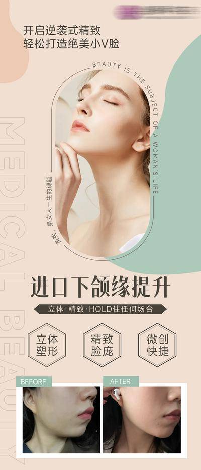【南门网dcpsd.com】海报 医美 活动 面部 下颌缘 提升 宣传 对比