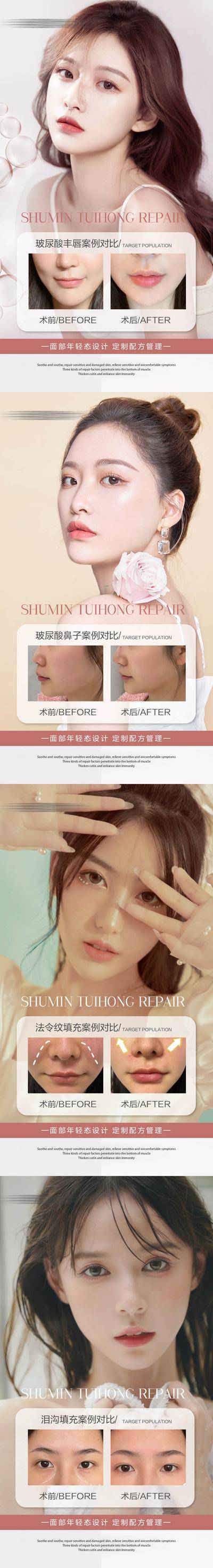 【南门网dcpsd.com】海报 医美 玻尿酸填充 面部填充 丰唇 案列 对比 系列
