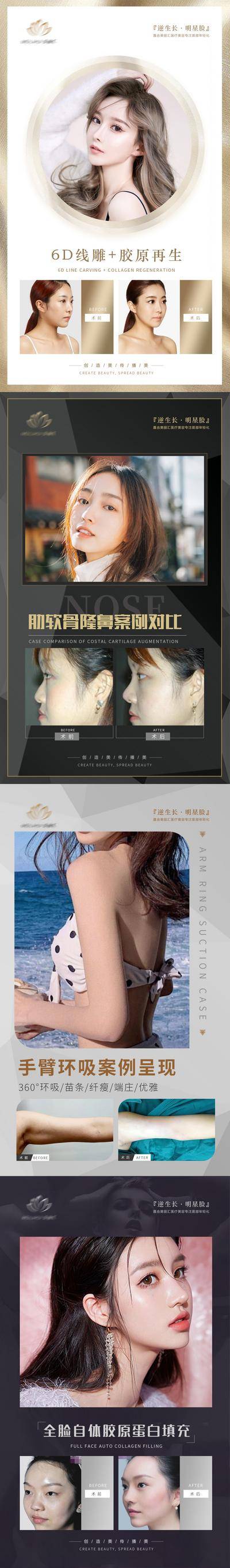 【南门网dcpsd.com】海报 医美 整形 美容 案例 对比 人物 瘦脸针 嗨体 祛颈纹 填充