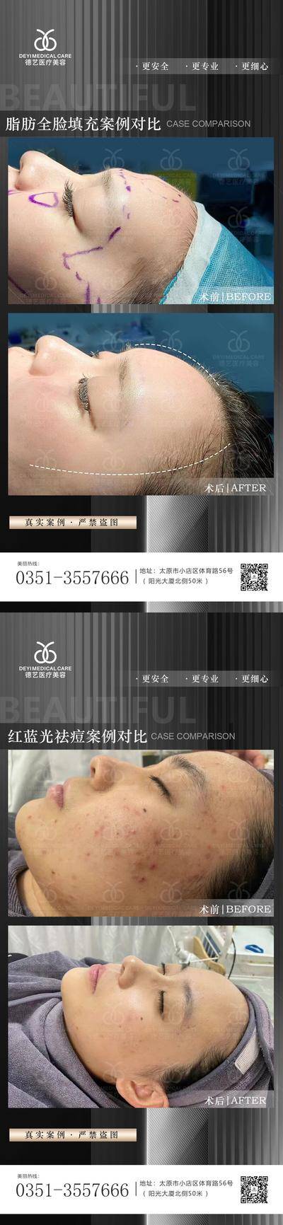 【南门网dcpsd.com】海报 医美 整形 美容 案例 对比图 黑色 高端