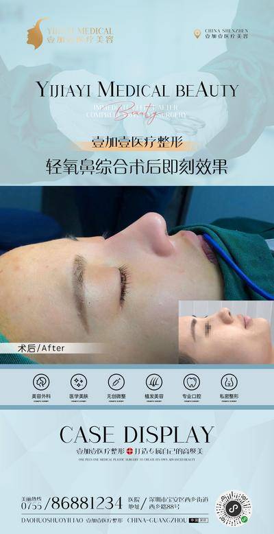 【南门网dcpsd.com】海报 医美 整形 案例 对比图