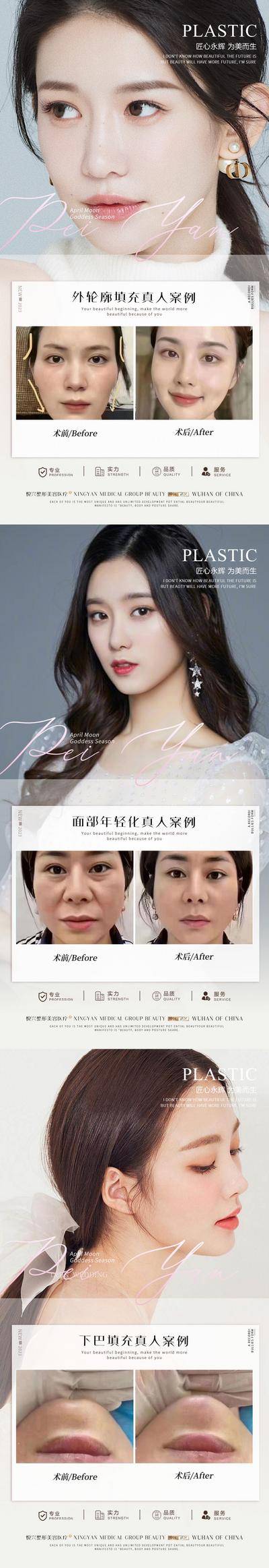 【南门网dcpsd.com】海报 医美 整形 案例 对比 线雕 抗衰 填充 玻尿酸 人物 系列