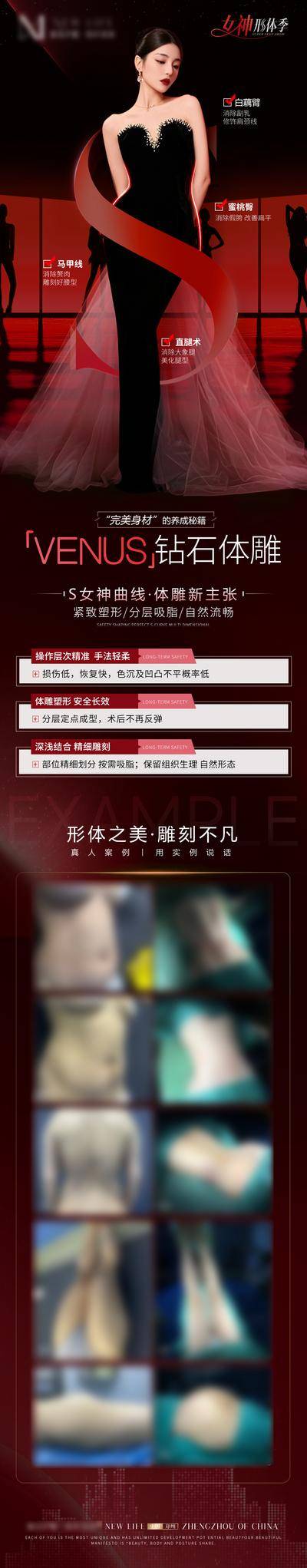 【南门网dcpsd.com】海报 长图 医美 整形 吸脂 体雕 人物 案例 对比