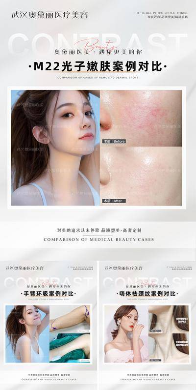 【南门网dcpsd.com】海报 医美 整形 美肤 光子嫩肤 颈纹 吸脂 案例 对比 人物
