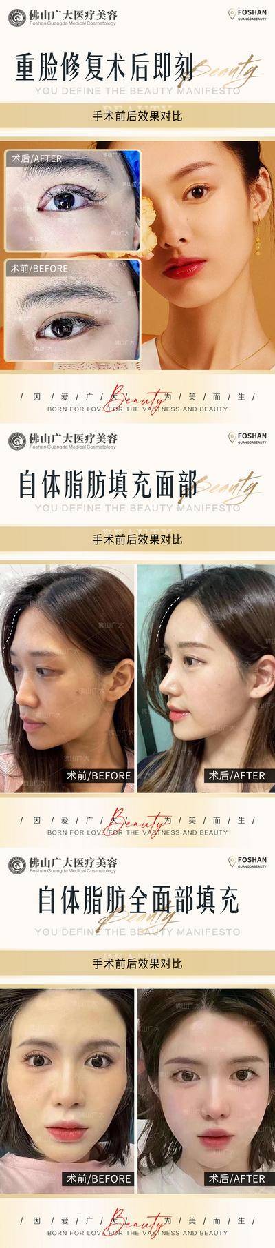 【南门网dcpsd.com】海报 长图 医美 整形 案例 对比 简约 人物