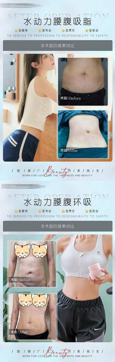 【南门网dcpsd.com】海报 医美 整形 美业 美容 案例 对比 简约 人物