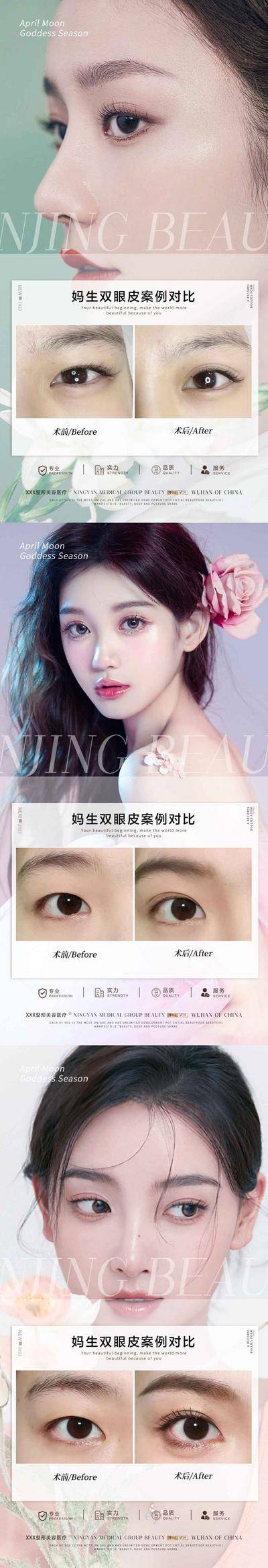 【南门网dcpsd.com】海报 医美 双眼皮 美容 整形 案例 眼综合 对比