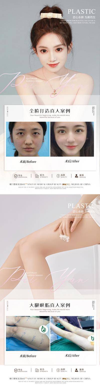 【南门网dcpsd.com】海报 医美 整形 全脸 打造 大腿 吸脂 案例 对比 人物 系列