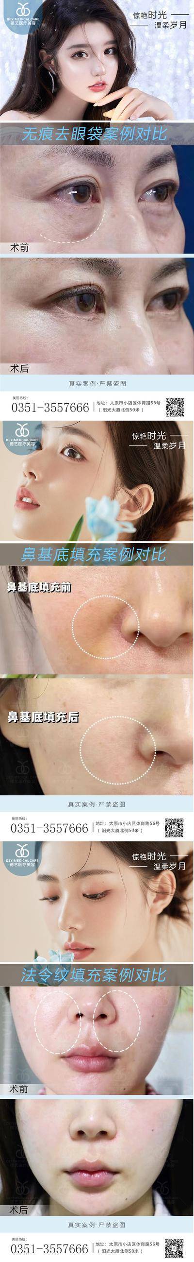 【南门网dcpsd.com】海报 医美 案例 对比图 系列 卖点