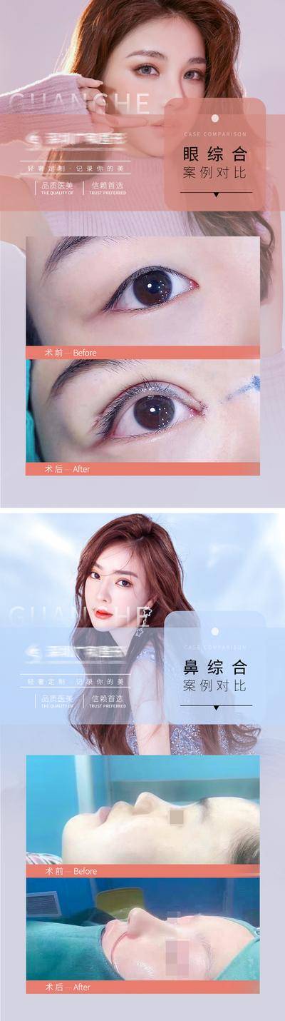 【南门网dcpsd.com】海报 医美 案例 整形 对比 双眼皮 隆鼻 