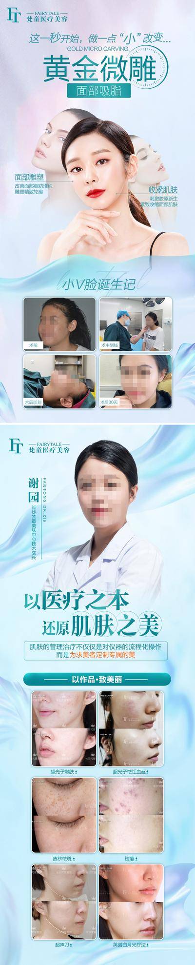 【南门网dcpsd.com】海报 医美 美容 整形 黄金微雕 案例对比 专家简介
