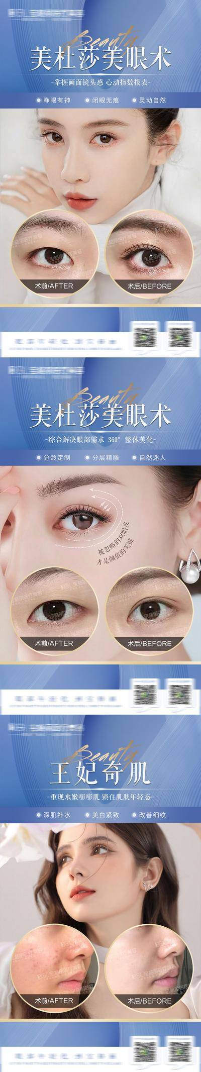【南门网dcpsd.com】海报 医美 整形 双眼皮 美肌 案例 对比 系列