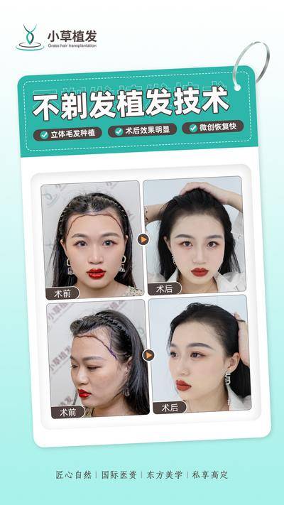 【南门网dcpsd.com】海报 医美 整形 案例对比 植发 模特