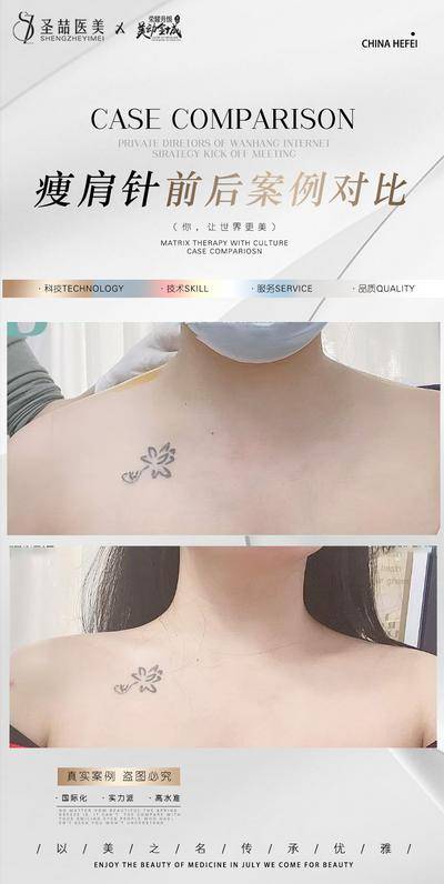 【南门网dcpsd.com】海报 医美 整形 案例 对比