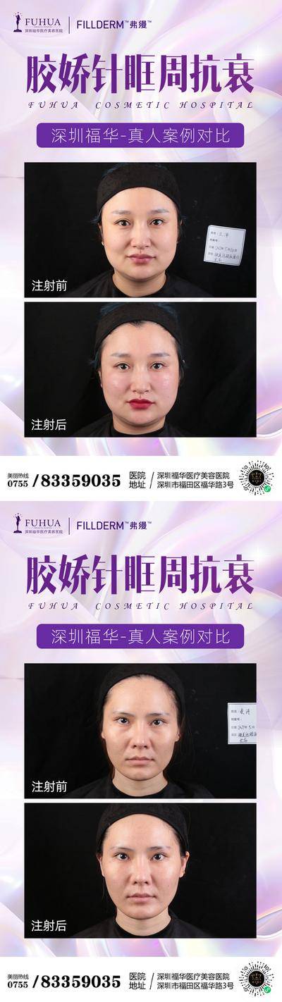 【南门网dcpsd.com】海报 医美 整形 抗衰 案例 对比