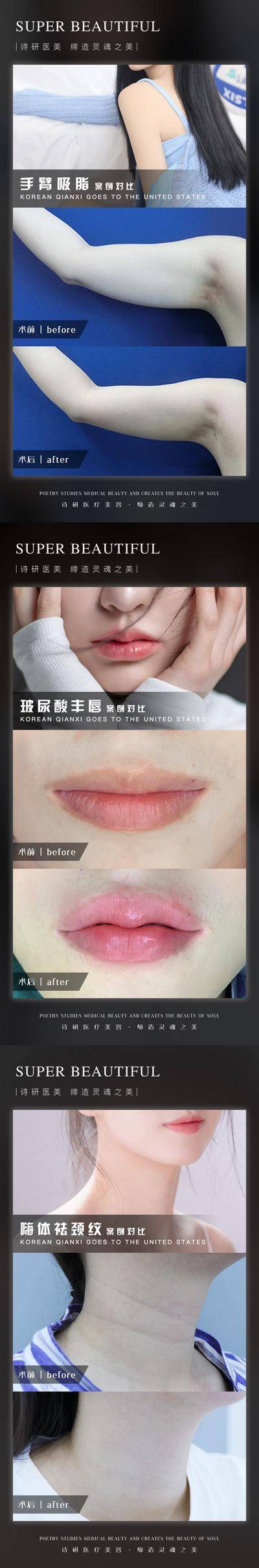 【南门网dcpsd.com】海报 医美 整形 美业 案例 对比 手臂吸脂 嗨体祛颈纹 玻尿酸丰唇