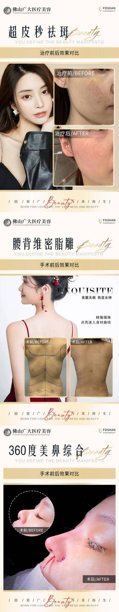 【南门网dcpsd.com】海报 医美 整形 案例 对比 简约 人物 祛斑 皮秒 吸脂 鼻部