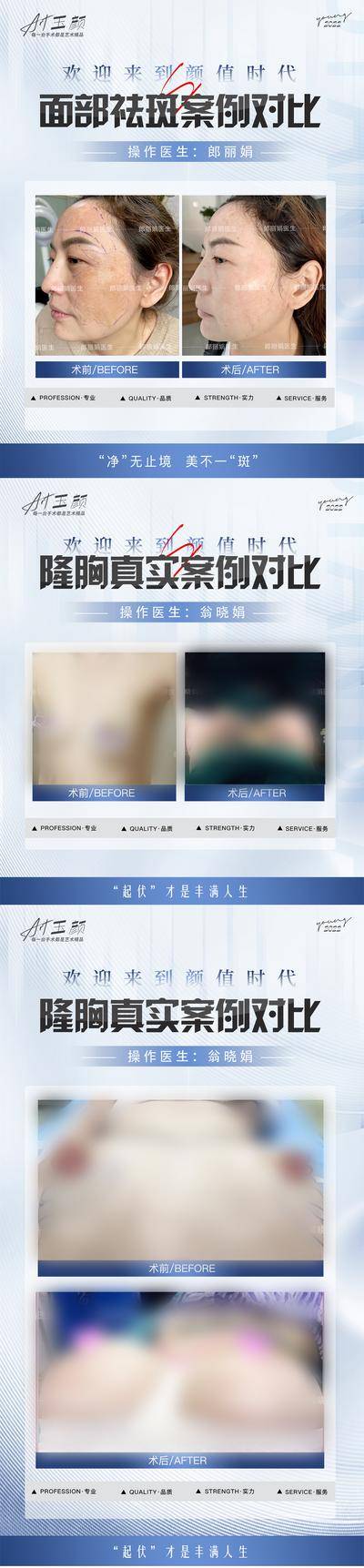 【南门网dcpsd.com】海报 长图 医美 整形 美容 案例 对比 丰胸 祛斑